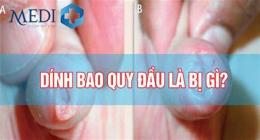 ảnh chụp màn hình bao quy đầu bị khô, bong da