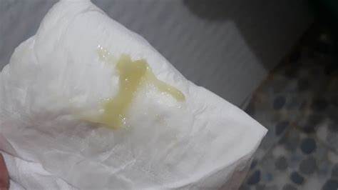 ảnh chụp màn hình bong nút nhầy bao lâu thì chuyển dạ