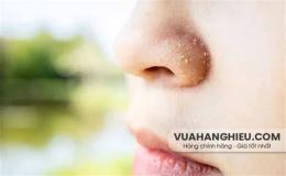 ảnh chụp màn hình cánh mũi bị khô bong da