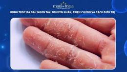 ảnh chụp màn hình da bị bong tróc do đâu