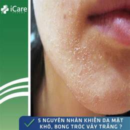 ảnh chụp màn hình da mặt khô bong da