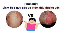 ảnh chụp màn hình đầu dương vật bị bong da