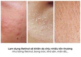 ảnh chụp màn hình dùng retinol có bị bong da không