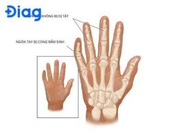 ảnh chụp màn hình ngón tay bị bong da là bị gì