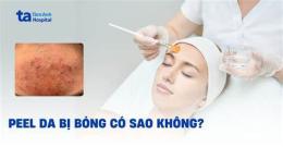 ảnh chụp màn hình peel da bị bỏng nhẹ