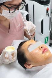 ảnh chụp màn hình peel da căng bóng