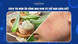 ảnh chụp màn hình trị bỏng da bằng nha đam