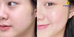 ảnh chụp màn hình uống gì để da căng bóng