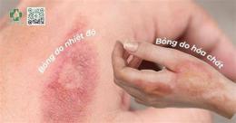 ảnh chụp màn hình vết bỏng lên da non