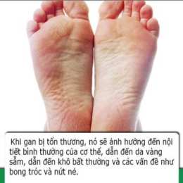 bàn chân bị bong tróc da