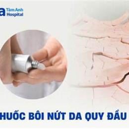 bao quy đầu bị khô, bong da