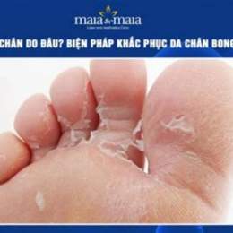 bong da chân là bệnh gì