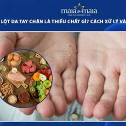 bong da chân tay là thiếu chất gì