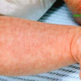 bông sữa da trẻ sơ sinh nổi vân hoa