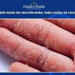 bong tróc da đầu ngón tay