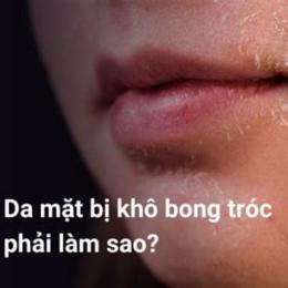 bong tróc da mặt
