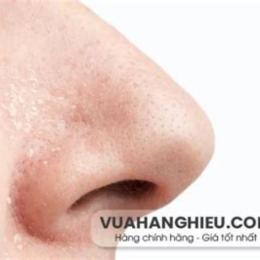 cánh mũi bị khô bong da