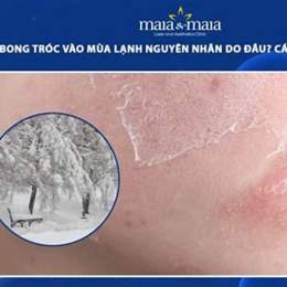 da bị khô bong tróc vào mùa đông