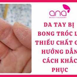 da chân bị bong tróc là thiếu chất gì