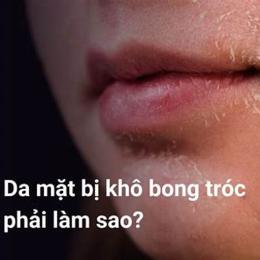 da chân bị khô, bong tróc phải làm sao