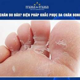 da chân bong tróc
