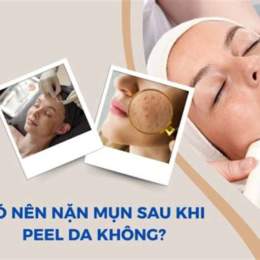 da đang bong sau peel nên làm gì