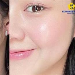 da mặt căng bóng