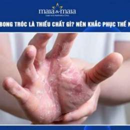 da tay bong tróc thiếu chất gì