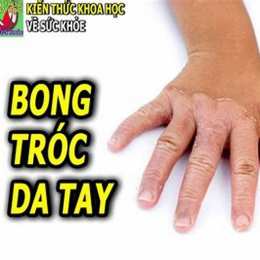 da tay chân khô bong tróc