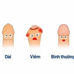 đầu dương vật bị bong da