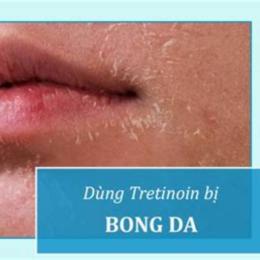 dùng tretinoin bị bong da bao lâu