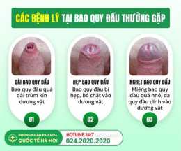 giao diện app bao quy đầu bị khô, bong da