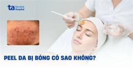 giao diện app da bong sau peel bị đỏ