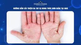 giao diện app da tay bị bong
