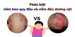 giao diện app đầu dương vật bị bong da