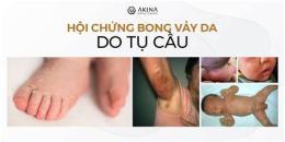 giao diện app hội chứng bong vảy da do tụ cầu
