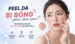 giao diện app peel da bị bỏng phải làm sao