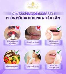 giao diện app phun môi bị bong da nhiều lần