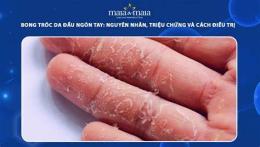 giao diện app tay bong tróc da