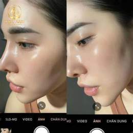 giao diện app tiêm căng bóng da mặt giá bao nhiêu