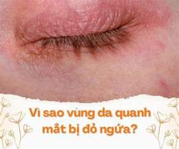 giao diện app vùng da quanh mắt bị khô, bong tróc phải làm sao