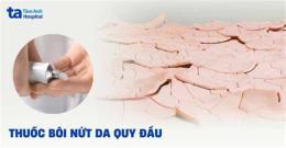 hướng dẫn sử dụng bao quy đầu bị khô, bong da