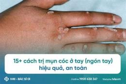 hướng dẫn sử dụng bị bong da ở đầu ngón tay là bệnh gì