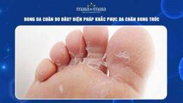 hướng dẫn sử dụng bong da chân là bệnh gì