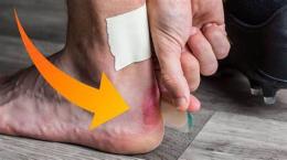 hướng dẫn sử dụng bong da gót chân
