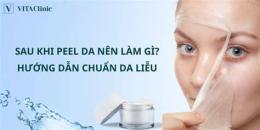 hướng dẫn sử dụng bong da sau peel