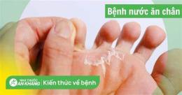 hướng dẫn sử dụng chân bị bong da là bệnh gì