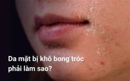 hướng dẫn sử dụng da đầu bong tróc từng mảng