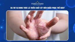 hướng dẫn sử dụng da tay bong tróc thiếu chất gì