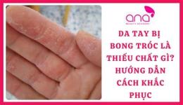 hướng dẫn sử dụng da tay khô bong tróc là thiếu chất gì